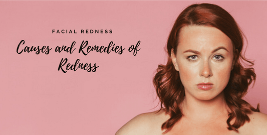 Do You Know the Causes of Facial Redness? Get the Best Natural Facial Redness Treatment Products